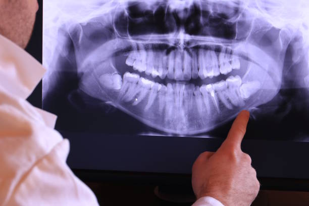Best Pediatric Emergency Dentist in Woodruff, SC