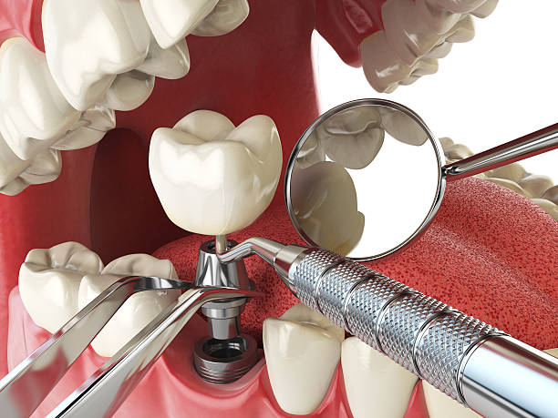 Best Emergency Orthodontic Repairs in Woodruff, SC